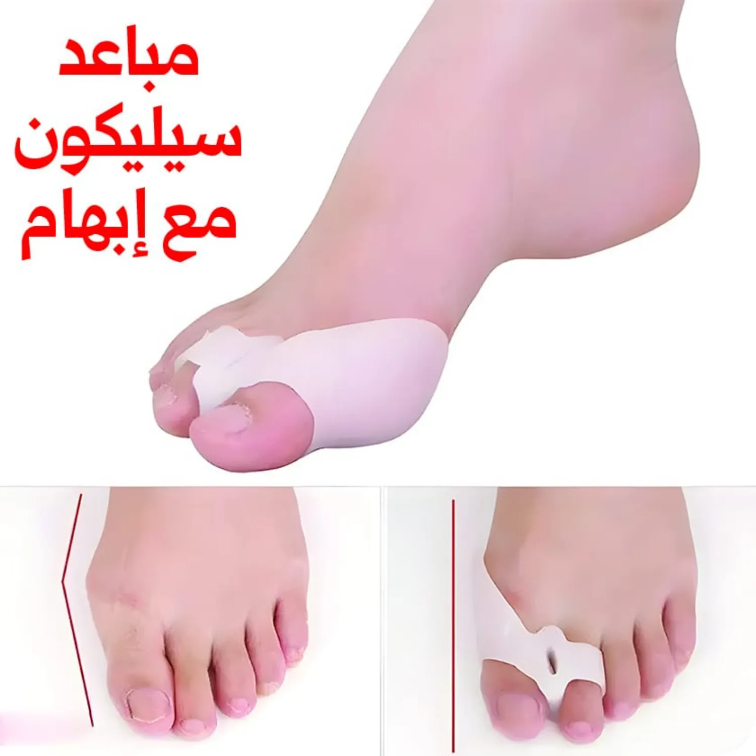 مباعد أصابع القدم سيليكون طبي لتصحيح انحراف الإبهام